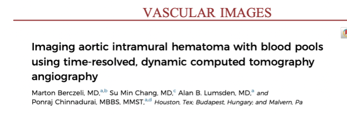 AlanLumsdenMD's tweet photo. Prior to this "dynamic" image, I had assumed that IMH converted to dissection primarily from a breach in intima.  This show blood pools filling from intercostals-- outside in or inside out progression? https://t.co/DboxiDeWXm
