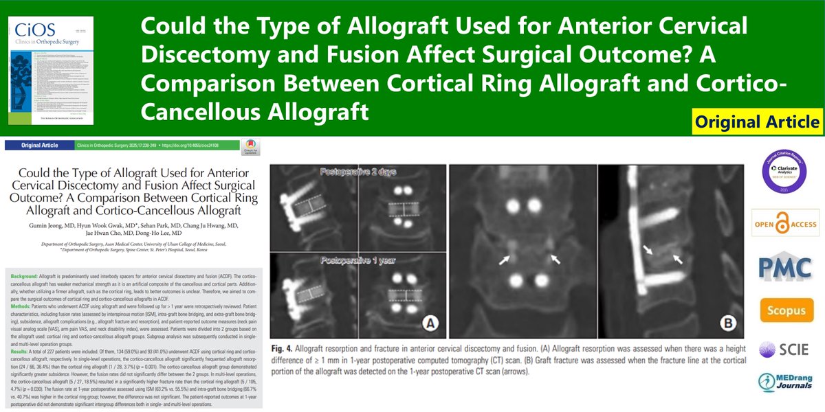 Could the Type of Allograft Used for Anterior Cervical Discectomy and Fusion Affect Surgical Outcome? A Comparison Between Cortical Ring Allograft and Cortico-Cancellous Allograft
🌷doi.org/10.4055/cios24…
2025 Apr;17(2)Gumin Jeong
#Cortical_ring_allografts #Surgical_outcomes