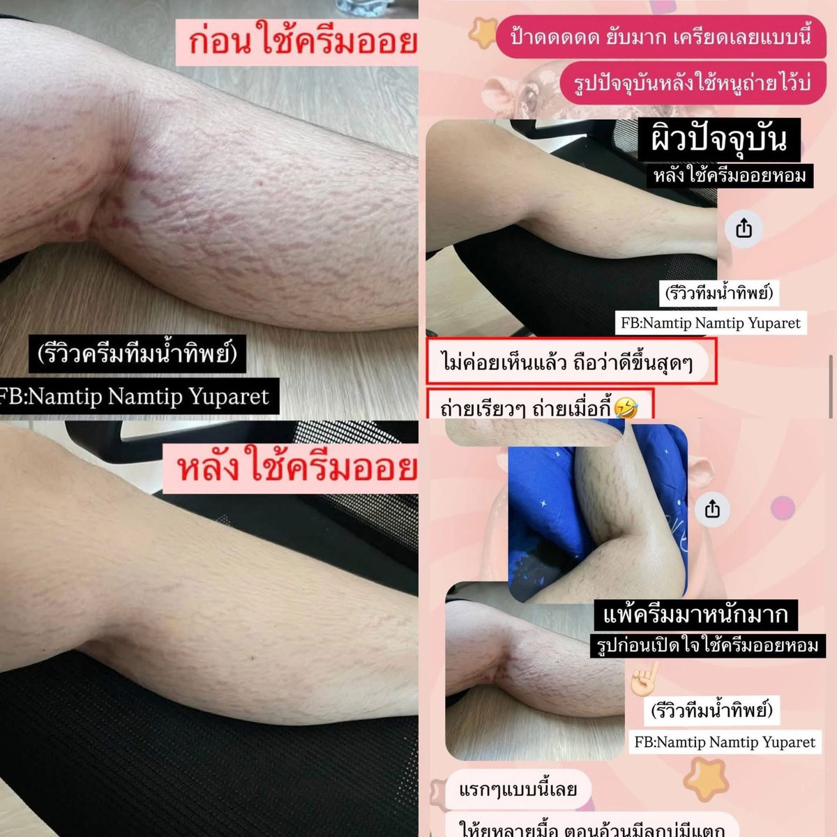 bb_wns's tweet photo. .ᐟ⨳ 💘🧸 อื อ หื อ รี วิ ว 🍒แหกมากกก ! #ครีมออยหอม
ผิวแตกลาย — : ) 🥇ผิ ว แ ห้ ง คุณแม่ตั้งครรภ์ 🐰ใช้ได้ ♡︎
•
𐙚 ₊🍠🥞 ตั ว เ ด็ ด ปราบรอย 𓍼🦙🌝ครีมออยอ่อนโยน“
กระปุกใหญ่ เนื้อเนียน 🔗🍧 กลิ่นหอม 𝐏𝐫𝐢𝐜𝐞 ✿ ͈🌿𝟑 𝟗 𝐎-. https://t.co/qxK1H2nP7H