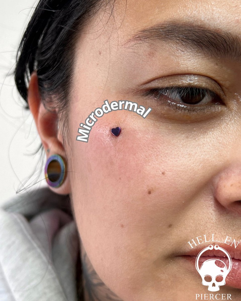 La evolución completa de Marcela ll✨🤯

Nuevo anclaje en el pómulo derecho para generar una linda simetría.🔥🔥

Así que si quieres un lindo microdermal no dudes en programar tu cita en <a href="/dollinkshop/">dollink</a> 😎