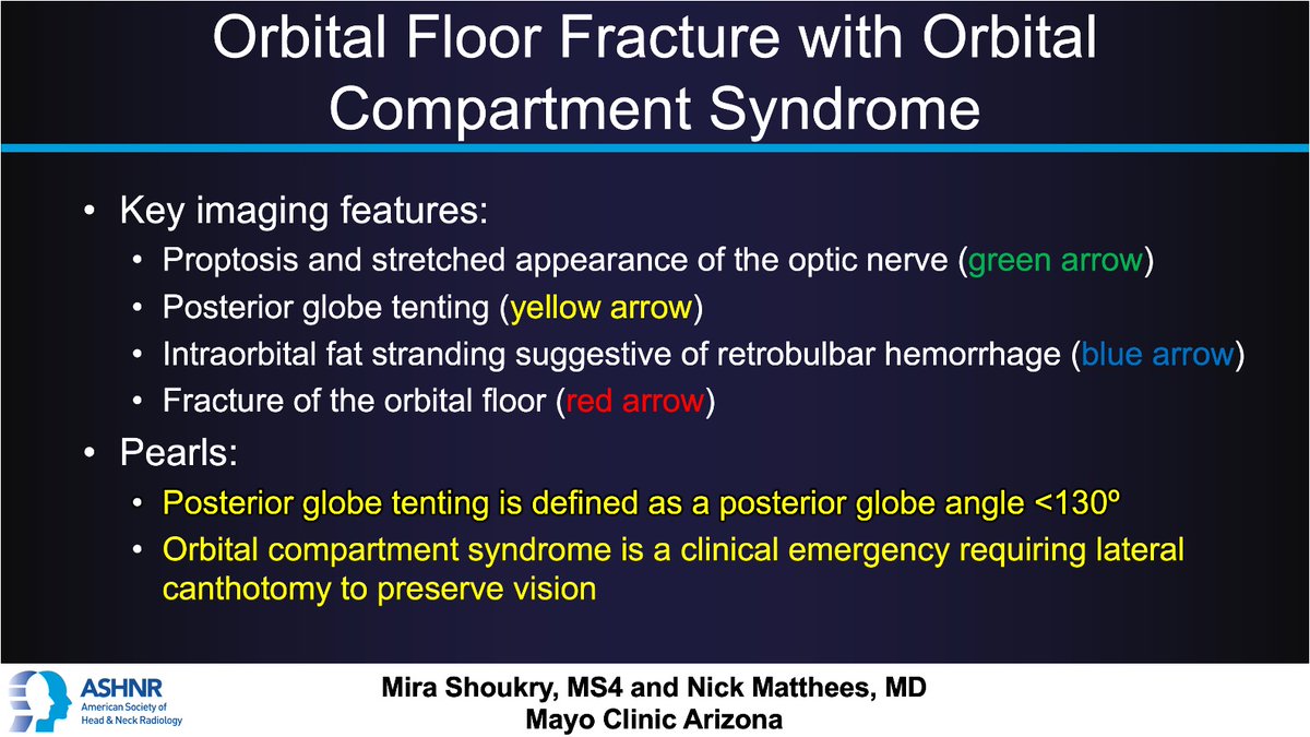 ASHNR (@ashnrsociety) on Twitter photo #ASHNRCOTW #301: ANSWER. Thx Mira Shoukry + Dr. Mathees 4 case! #ASHNR25
<a href="/callyrobs/">Caroline Robson, MBChB</a> <a href="/DShatzkes/">Deborah Shatzkes</a> <a href="/CDP_Rad/">C Douglas Phillips 🇺🇸</a> <a href="/rhwiggins/">Richard Wiggins</a>
<a href="/nakoontz/">Nicholas Koontz</a> <a href="/KRileyMD/">Kalen Riley</a> <a href="/CMGlastonbury/">Christine M Glastonbury, MD</a> <a href="/tabby_kennedy/">Tabby A. Kennedy, MD</a> <a href="/PhilipRChapman1/">Philip R. Chapman, MD</a> <a href="/cmtomblinson/">Courtney Tomblinson, MD</a>
<a href="/amyfjuliano/">Amy Juliano</a> <a href="/bpoliceni/">Bruno Policeni</a> <a href="/MohitTCCNeuro/">Mohit Agarwal</a> <a href="/AshokSrini15/">Ashok Srinivasan</a> <a href="/KatieTraylorDO/">Katie S. Traylor MS, DO, DABR</a> #ASHNRCOTW #301: ANSWER. Thx Mira Shoukry + Dr. Mathees 4 case! #ASHNR25
<a href="/callyrobs/">Caroline Robson, MBChB</a> <a href="/DShatzkes/">Deborah Shatzkes</a> <a href="/CDP_Rad/">C Douglas Phillips 🇺🇸</a> <a href="/rhwiggins/">Richard Wiggins</a>
<a href="/nakoontz/">Nicholas Koontz</a> <a href="/KRileyMD/">Kalen Riley</a> <a href="/CMGlastonbury/">Christine M Glastonbury, MD</a> <a href="/tabby_kennedy/">Tabby A. Kennedy, MD</a> <a href="/PhilipRChapman1/">Philip R. Chapman, MD</a> <a href="/cmtomblinson/">Courtney Tomblinson, MD</a>
<a href="/amyfjuliano/">Amy Juliano</a> <a href="/bpoliceni/">Bruno Policeni</a> <a href="/MohitTCCNeuro/">Mohit Agarwal</a> <a href="/AshokSrini15/">Ashok Srinivasan</a> <a href="/KatieTraylorDO/">Katie S. Traylor MS, DO, DABR</a>