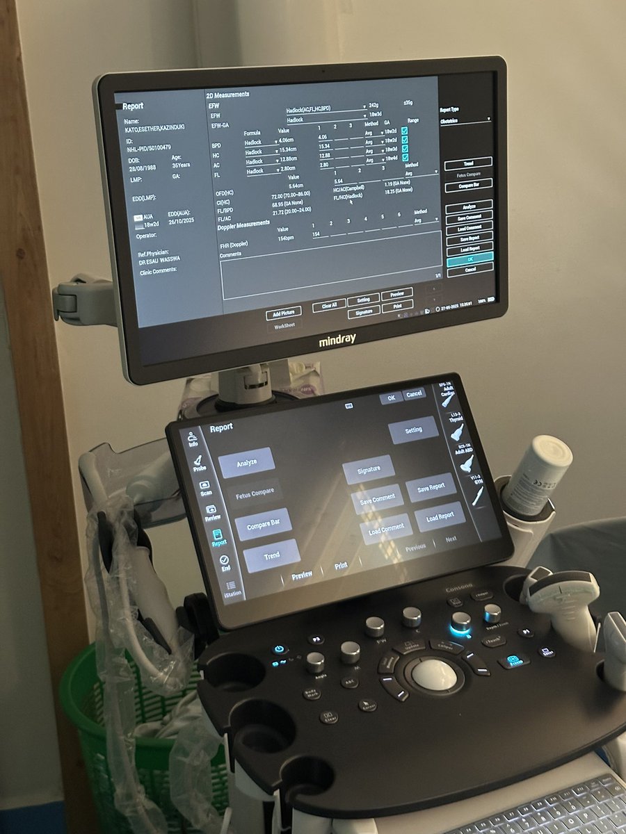 Our Radiology Department recently got a boost with the latest ultrasound machine now on board! This recent addition means shorter wait times, faster results, and more comfort for our patients. 
Experience advanced imaging care at Nakasero Hospitalwhere your health comes first.