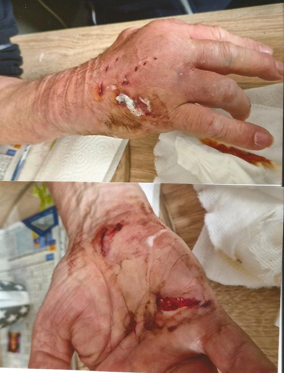 Das war nur ein kleiner Hundebiss. Vor 2,5 Wochen her