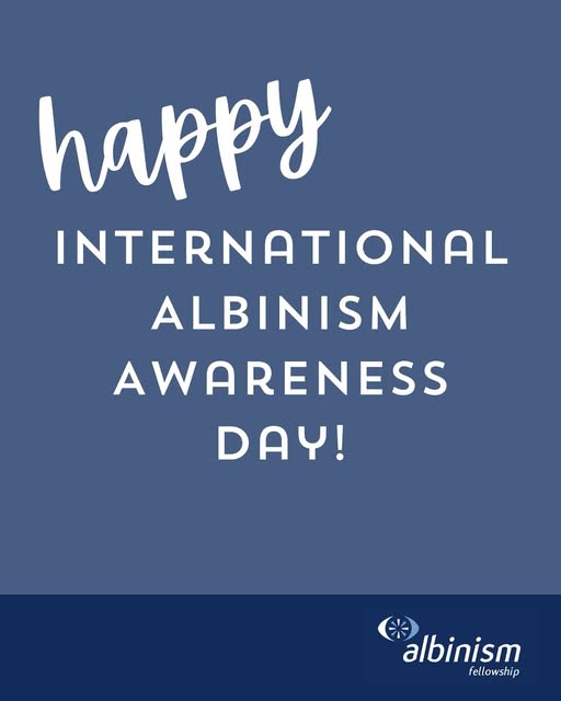 FeachIreland's tweet image. Happy International Albinism Awareness Day! @AlbinismUK @Vision_Irl @eclo_ie @ChildVisionVI @visionsportsirl