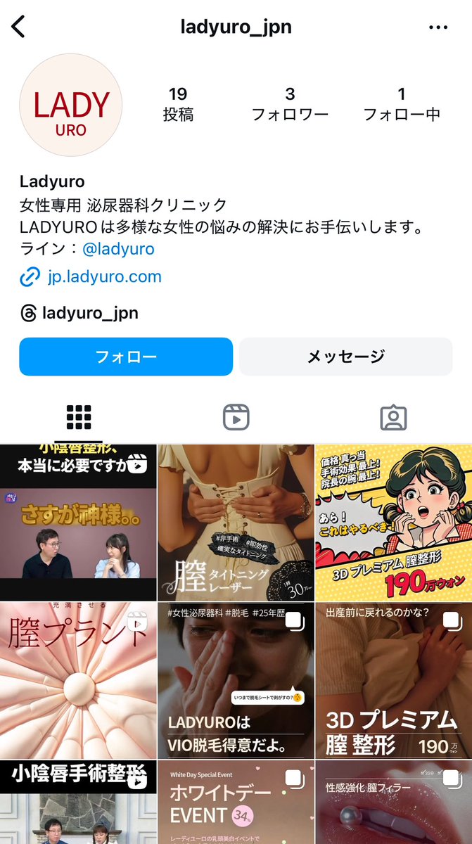 lisblanc_15's tweet photo. 今回🇰🇷 @ladyuro_ で小陰唇縮小ビラビラカット片方した！抜糸は🇯🇵でして片側だけで10鍼も細かく縫ってくれてて、抜糸の先生も綺麗って絶賛してた👏
痛みはトイレ3回目くらいまで痛かったけどその後は無痛。悩んでなかった私でも完璧にする事で満足したから、少しでも悩んでる人は今すぐやるべき！ https://t.co/Cohya5LJ1I