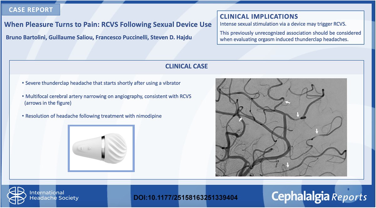 🧠 RCVS and unusual triggers: a case to reflect on

Reversible cerebral vasoconstriction syndrome (RCVS) is a rare cause of thunderclap headache, often linked to exertion, stress, or vasoactive exposures.

A new case highlights a previously undocumented trigger—underscoring the