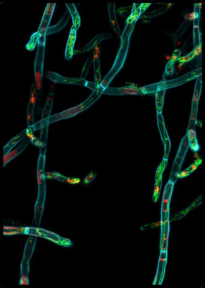 MRC Centre for Medical Mycology (@mrccmm) on Twitter photo Today's stunning #imageoftheweek is by <a href="/tina_bedekovic/">Tina Bedekovic</a> showing Candida albicans hyphae (blue), mitochondria (green) and vacuoles (red) captured during invasive growth. #science #mycology #research #health #microscopy Today's stunning #imageoftheweek is by <a href="/tina_bedekovic/">Tina Bedekovic</a> showing Candida albicans hyphae (blue), mitochondria (green) and vacuoles (red) captured during invasive growth. #science #mycology #research #health #microscopy