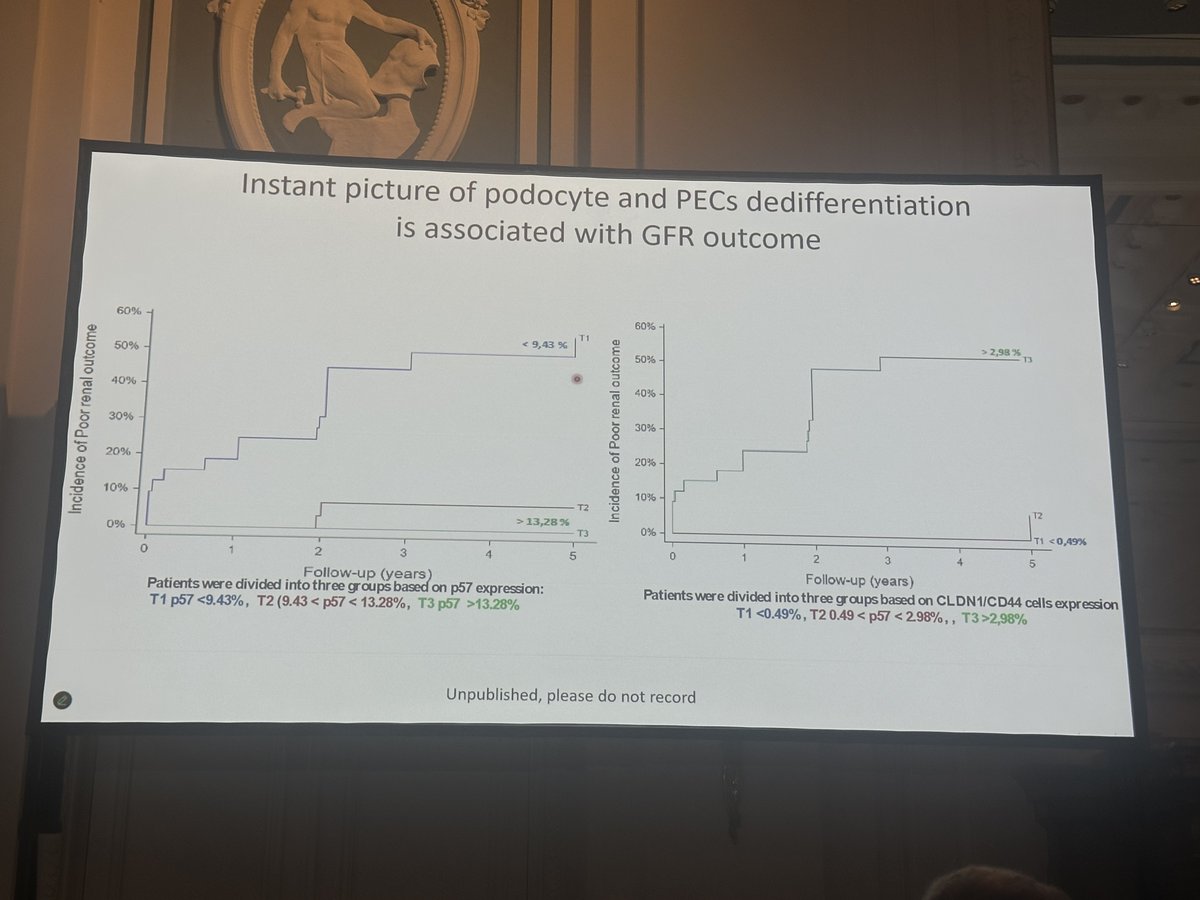 ISGD_la (@isgd_la) on Twitter photo 🥰 Amamos al podocito 🐙 pero sabemos que no lo es todo
🤩 Papel de las PECs en la formación de semi 🌙
🔴 Desdiferenciación de PECS ➡️ Peor pronóstico ⚠️
Dr. Pierre-Louis Tharaux
#PodocyteConference 🐙
<a href="/ISGDtweets/">International Society of Glomerular Disease</a>
<a href="/PodocyteIPC/">International Podocyte Conference</a> 🥰 Amamos al podocito 🐙 pero sabemos que no lo es todo
🤩 Papel de las PECs en la formación de semi 🌙
🔴 Desdiferenciación de PECS ➡️ Peor pronóstico ⚠️
Dr. Pierre-Louis Tharaux
#PodocyteConference 🐙
<a href="/ISGDtweets/">International Society of Glomerular Disease</a>
<a href="/PodocyteIPC/">International Podocyte Conference</a>