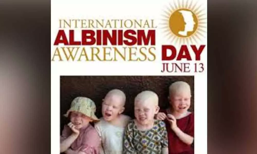 a_tetubatya's tweet photo. To everyone living with albinism:
You are not invisible.
You are not a curse.
You are not alone.
Your life matters. Your light is beautiful. Your strength inspires.
On this day and always, I stand with you. 💛
#InternationalAlbinismAwarenessDay #StandWithAlbinism https://t.co/XyydnQgmAo