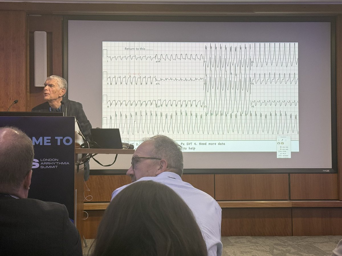 DrAshNisbet (@drashnisbet) on Twitter photo Absolute masterclass in ECG interpretation from a true legend in EP <a href="/GeorgeKleinMD/">George Klein</a> <a href="/LDN_Arrhythmia/">London Arrhythmia Summit</a> Absolute masterclass in ECG interpretation from a true legend in EP <a href="/GeorgeKleinMD/">George Klein</a> <a href="/LDN_Arrhythmia/">London Arrhythmia Summit</a>