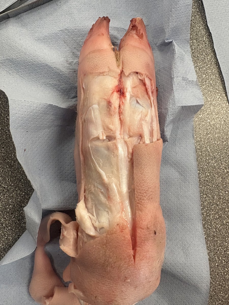 Both Sports Skills classes, taught by Mr Martin and Miss De Bunsen have started positively. Picked as one of their options moving into KS4, the students have begun the exam content, focusing on the skeletal and muscular system. In order to apply their knowledge and use the