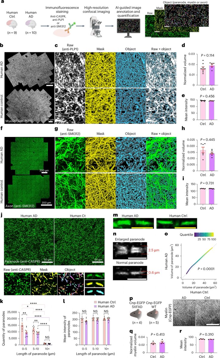 John Lukens (@lukensjohnr) on Twitter photo Myelin–axon interface vulnerability in Alzheimer’s disease revealed by subcellular proteomics and imaging of human and mouse brain
nature.com/articles/s4159… <a href="/NatureNeuro/">Nature Neuroscience</a> Myelin–axon interface vulnerability in Alzheimer’s disease revealed by subcellular proteomics and imaging of human and mouse brain
nature.com/articles/s4159… <a href="/NatureNeuro/">Nature Neuroscience</a>