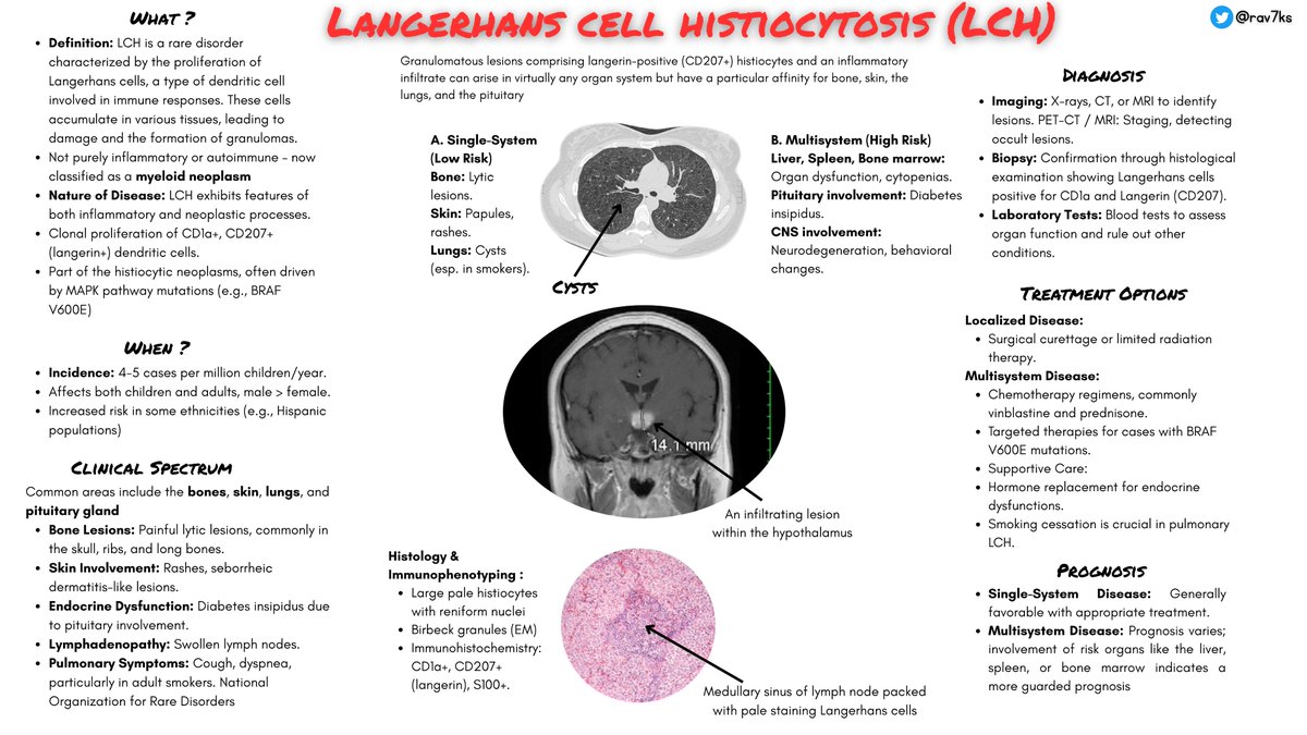 📌 Langerhans Cell Histiocytosis (LCH)
LCH is a myeloid neoplasm with features of both inflammation &amp; malignancy.
🔬 Clonal CD1a+, CD207+ dendritic cells
🦴 Bone, 🫁 lung, 🧠 pituitary involvement common
#MedTwitter