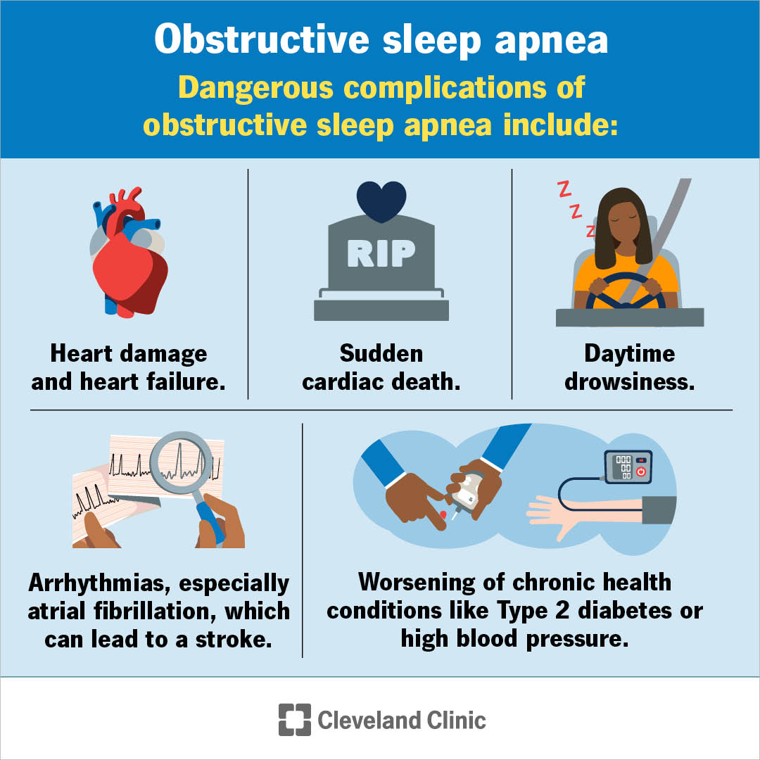 Obstructive sleep apnea affects both men and women, but it's more common in men. Left untreated, it can raise the risk of serious health issues, even sudden cardiac death.

😴 In honor of #MensHealthMonth, make your health a priority. Schedule that sleep study you've been putting