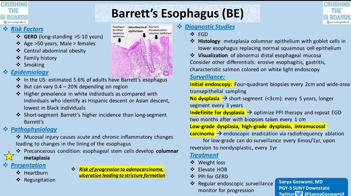 Barrett‘s Esophagus by Dr. Sanya Goswani, USA