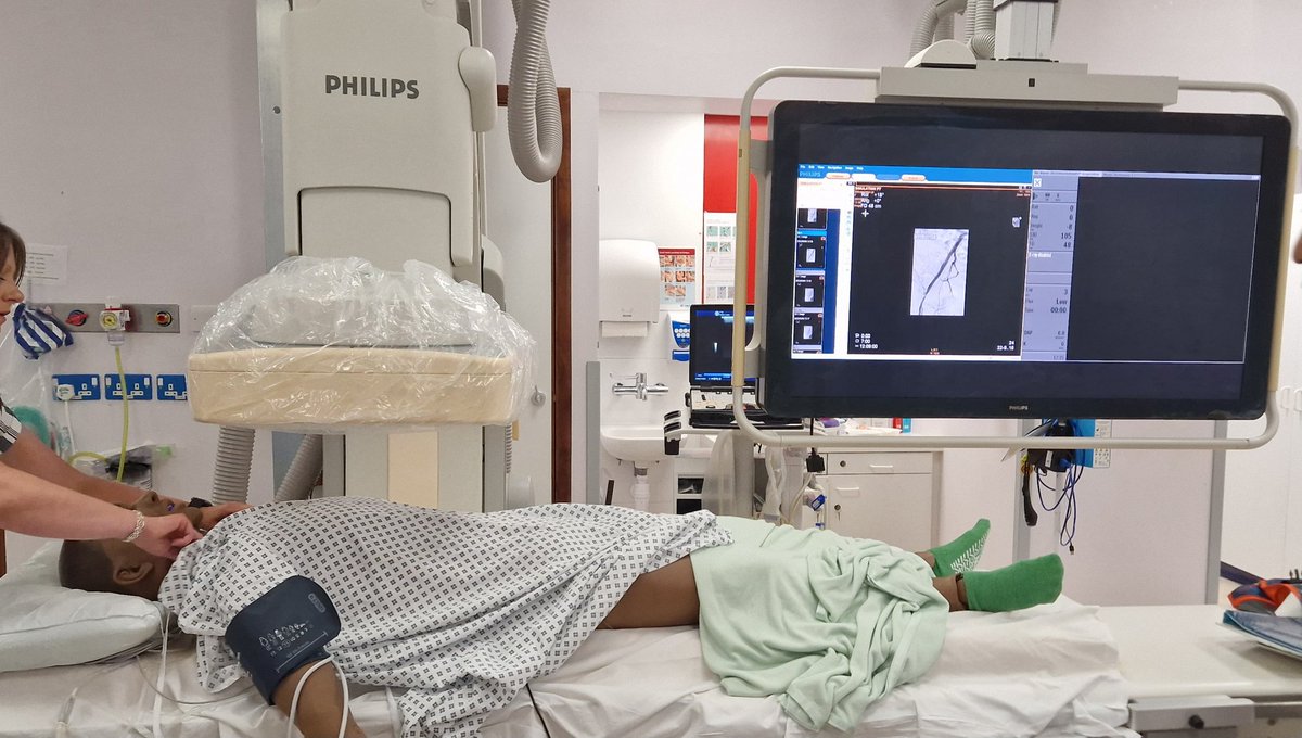 Simulation Tech Drew (@simtechdrew) on Twitter photo Todays insitu Sim was delivered in radiology. 73 year old patient in for a bilateral iliac arterial angioplasty. The team were able to identify when the blood pressure started dropping. Well done to all that were involved. <a href="/QEMedEducation/">QE Gateshead Medical Education</a> <a href="/NEsimulation/">NEsimulation</a> #simtech Todays insitu Sim was delivered in radiology. 73 year old patient in for a bilateral iliac arterial angioplasty. The team were able to identify when the blood pressure started dropping. Well done to all that were involved. <a href="/QEMedEducation/">QE Gateshead Medical Education</a> <a href="/NEsimulation/">NEsimulation</a> #simtech