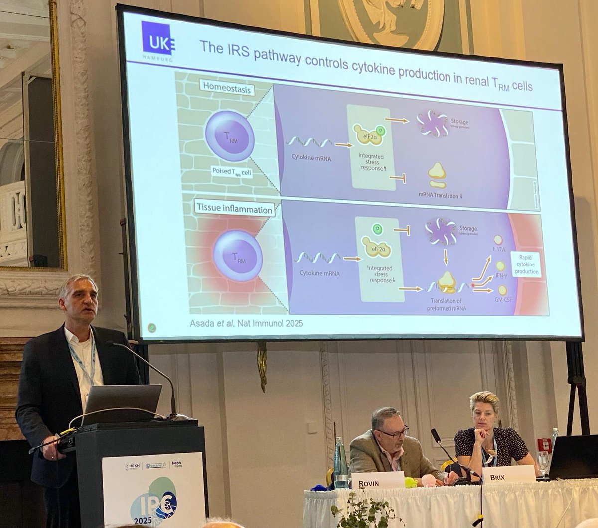 ISGDtweets's tweet image. Brilliant talk by Prof. Ulf Panzer at the #PodocyteConference 🐙 From immune-profiling to precise treatment 🎯 @NatureComms and a new hypothesis involving Granzyme K in ANCA-GN 🌟 @HCKH_Hamburg @PodocyteIPC @Tobias_B_Huber @KSusztak @JochenReiser @rkramann
