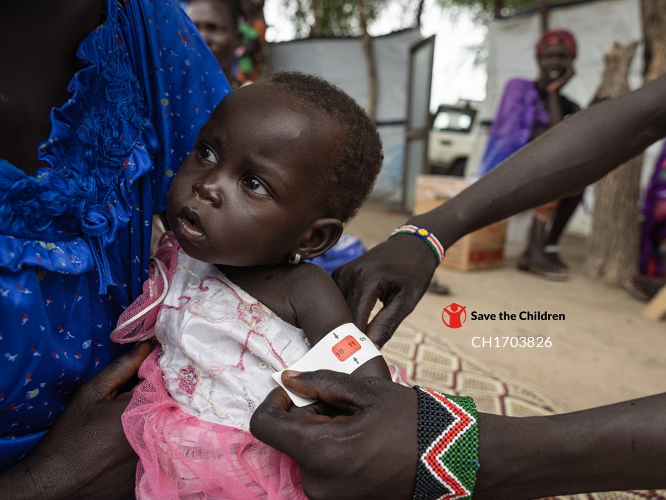 Acute malnutrition soars in South Sudan with millions of children at risk following aid cuts. savethechildren.net/news/acute-mal…