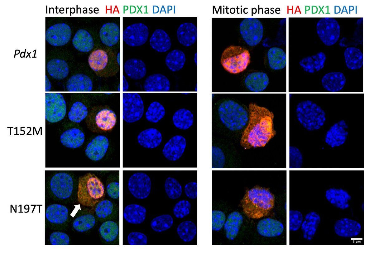 Discover how a PDX1 mutation can disrupt pancreas development: insight.jci.org/articles/view/…

ASCI member Doris Stoffers &amp; team now identify a PDX1 missense mutation that causes neonatal diabetes and impairs an important protein-protein interaction.