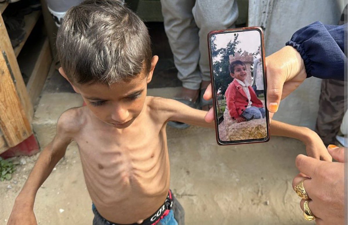 MotazSaleh2001's tweet photo. He is severely malnourished.💔

If you see this child, reply with🍉 🇵🇸 pray for him 💔 https://t.co/lfSEtSahlW