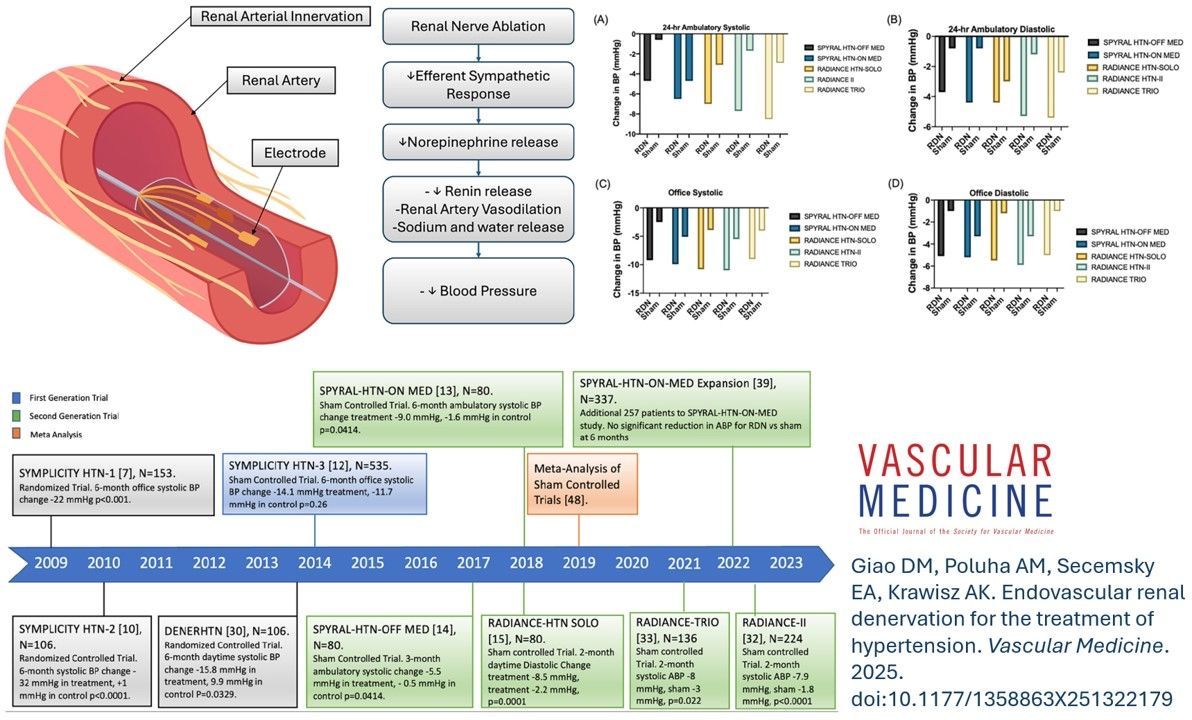 Online First! In this comprehensive review, Giao and colleagues summarize current literature on the safety and effectiveness of endovascular renal denervation for management of patients with hypertension. 
doi.org/10.1177/135886…
#Hypertension #RenalDenervation