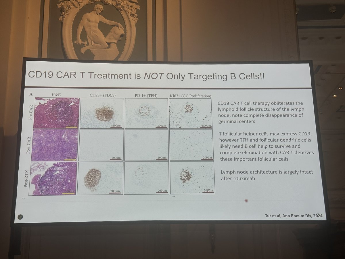ISGD_la's tweet image. CART-T cells en nefritis lúpica 🐺 (2/3) 🧵 

⬆️ depleción de células B vs obinutuzumab

📈 cuando se reconstituyen las cels. B  son vírgenes (naive)

⬆️ depleción en tejido linfático

⬇️ cels. Th foliculares y cels. dendríticas

#PodocyteConference 🐙 

@ISGDtweets
@PodocyteIPC