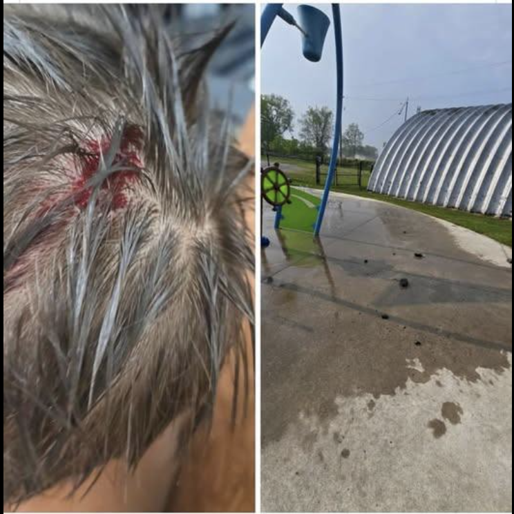 Teens come forward to police after child injured at Picton splash pad
quinteist.com/teens-come-for…