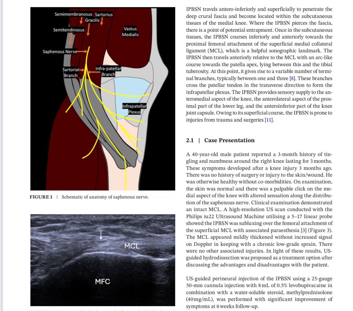 mskradiology4u (@mskradiology4u1) on Twitter photo Latest publication of 2025
doi.org/10.1002/sono.1…
<a href="/ROHImaging/">ROHImaging</a> <a href="/ROHNHSFT/">The Royal Orthopaedic Hospital</a> <a href="/BSSR_Site/">BSSR</a> <a href="/MSKSocietyIndia/">MSS India</a> <a href="/ESSRmsk/">European Society of Musculoskeletal Radiology</a> <a href="/intskeletal/">International Skeletal Society | ISS</a> Latest publication of 2025
doi.org/10.1002/sono.1…
<a href="/ROHImaging/">ROHImaging</a> <a href="/ROHNHSFT/">The Royal Orthopaedic Hospital</a> <a href="/BSSR_Site/">BSSR</a> <a href="/MSKSocietyIndia/">MSS India</a> <a href="/ESSRmsk/">European Society of Musculoskeletal Radiology</a> <a href="/intskeletal/">International Skeletal Society | ISS</a>