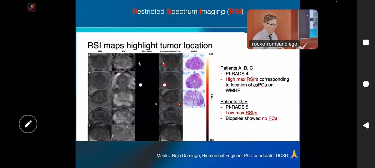 Dr. Ross Schwartzberg presented at yesterday's Radiology Grand Rounds, on the topic of #ProstateMRI.  Thanks for taking time to meet with us, and sharing recent advancements to support the novel use of MRI for cancer care. ♥️✌️

#Radiology #AcademicRadiology #GrandRounds #MedEd