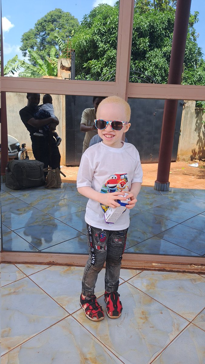 AmulenWinnie's tweet photo. Jojo has albinism and unlimited potential. we celebrate him and every child walking boldly in their light. 
Albinism doesn’t limit dreams.
Jojo is smart, joyful, curious, and just as capable as any other child.
We see him, we believe in him.
#AlbinismAwareness #DifferentNotLess https://t.co/Tu57IDQhDw