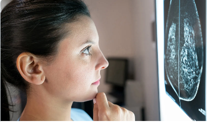 Dense breast tissue can hide cancer on a mammogram — a serious issue for nearly 50% of women over 40.

DBI's <a href="/DrWendieBerg/">DrWendieBerg</a> notes: “Mammograms miss ~40% of cancers in women with dense breasts.”
Full story <a href="/WebMD/">WebMD</a>: webmd.com/breast-cancer/…
#BreastCancer #DenseBreasts