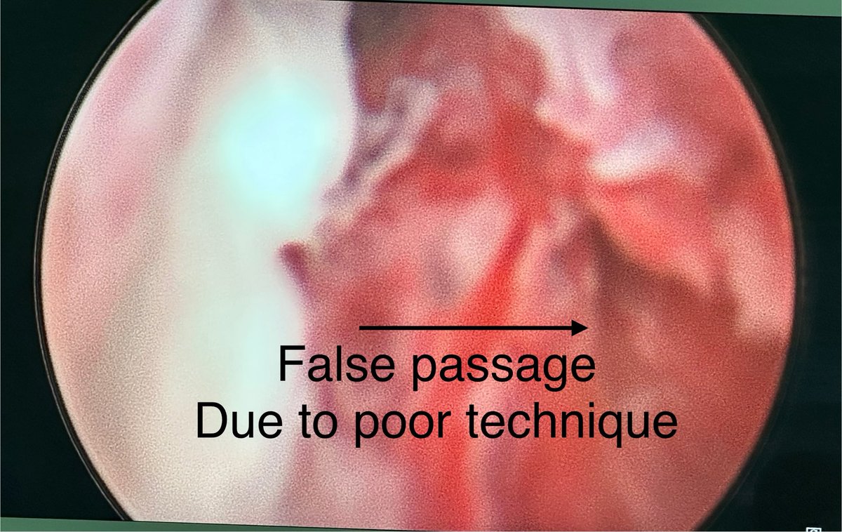 How can we teach better catheterisation techniques to reduce urethral damage?