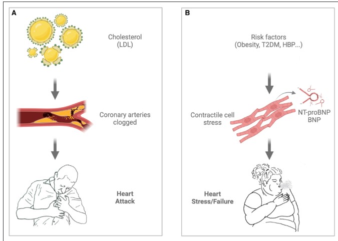 Circulation (@circaha) on Twitter photo Regularly monitoring heart peptide (natriuretic peptides) levels should become standard practice. Waiting for symptoms to manifest misses the critical window for early intervention. ahajournals.org/doi/full/10.11… Regularly monitoring heart peptide (natriuretic peptides) levels should become standard practice. Waiting for symptoms to manifest misses the critical window for early intervention. ahajournals.org/doi/full/10.11…