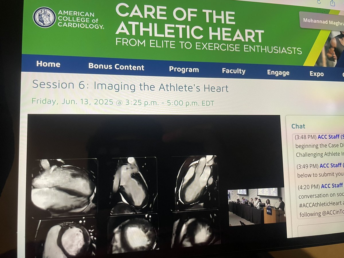 DrMKMaghrabi's tweet image. #ACCAthleticHeart
Enjoying the interesting and challenging cardiac imaging cases highlighting important considerations when evaluating an athlete’s heart 🫀