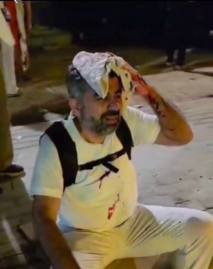 Sisi yönetimi ve Baltacı gruplar refah sınır kapısına yürüyen Gazze gönüllülerine saldırdı. 

#Openwaytogaza