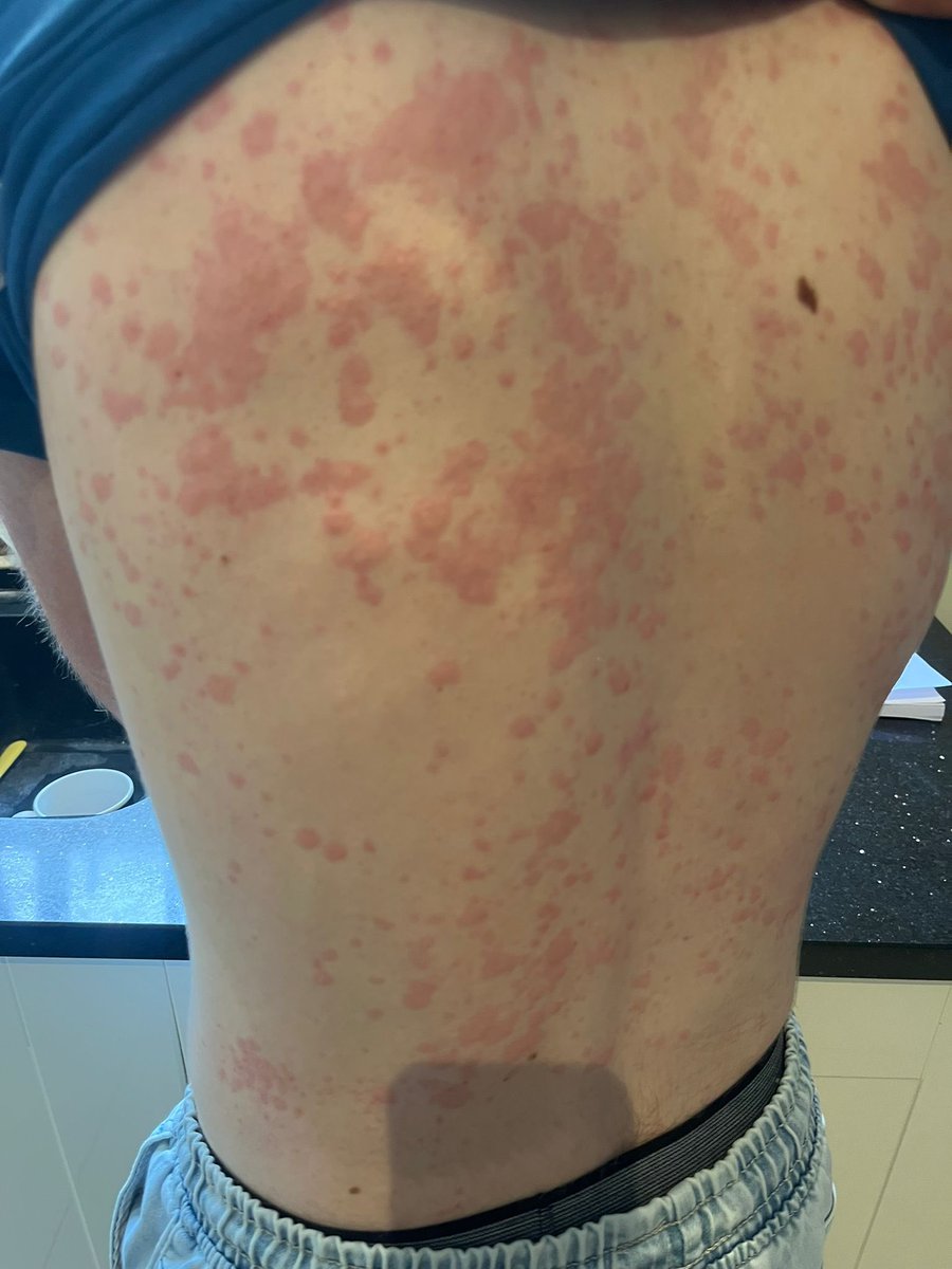 Harry Scarfe 🎙️ tweet media