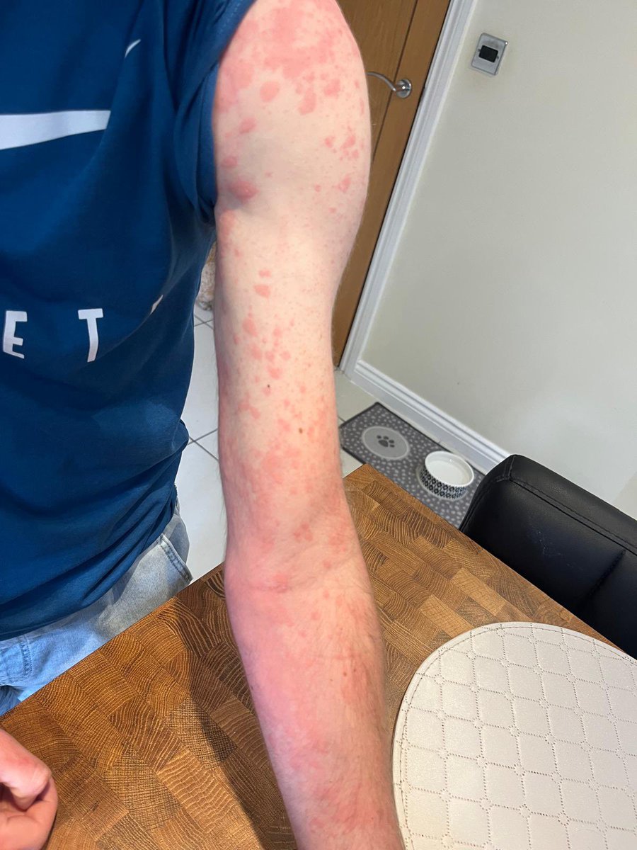 Harry Scarfe 🎙️ tweet media