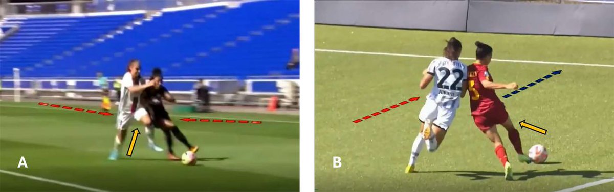 ⚠️ Hamstring injuries in women's football (soccer) ⚽️

NEW #OriginalResearch presenting systematic video analysis of 57 hamstring injuries 📹

Read👇 to better understand the injury mechanisms, situational patterns and biomechanics 📄

bit.ly/43HUBEZ