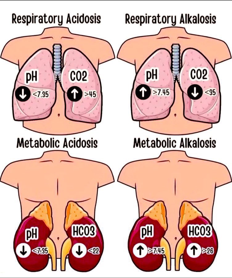 abdulhamid_199's tweet photo. افضل صورة تختصر لك 

Alkalosis and Acidosis

جدا مفيدة 
لان الكثير يلخبط فيها https://t.co/8HVlsMbgrt