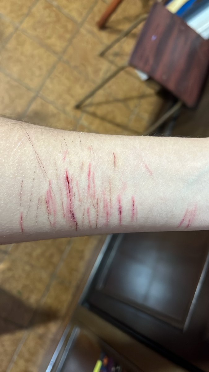 Ins4neAng3l's tweet photo. Old ;-; #shtwt #sh #selfharm #selfharmwarning https://t.co/148WkIGbYK