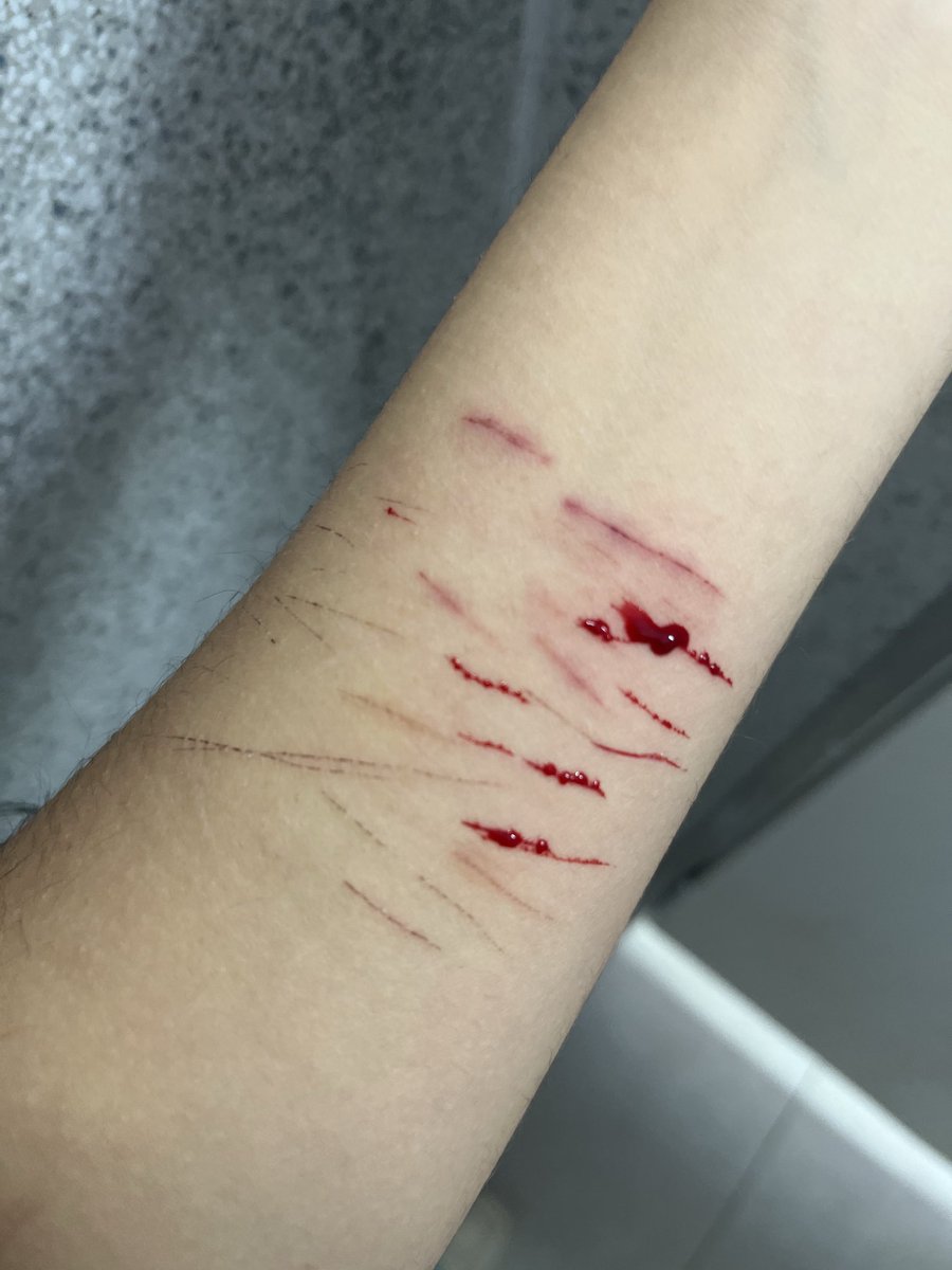 Ins4neAng3l's tweet photo. Old ;-; #shtwt #sh #selfharm #selfharmwarning https://t.co/148WkIGbYK