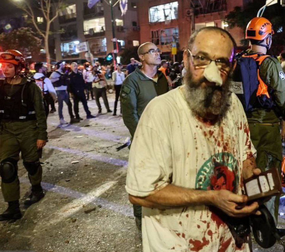 A Zionist rat, stunned and bleeding, stumbles through the streets of occupied Palestine after taking a direct hit from our missile strike.