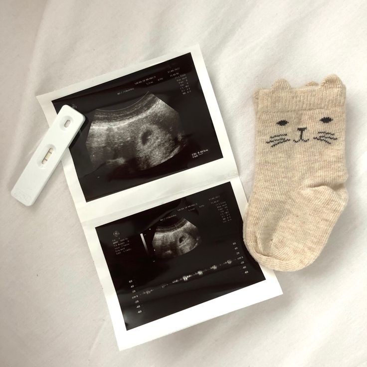 dani ❀.ྀི tweet media