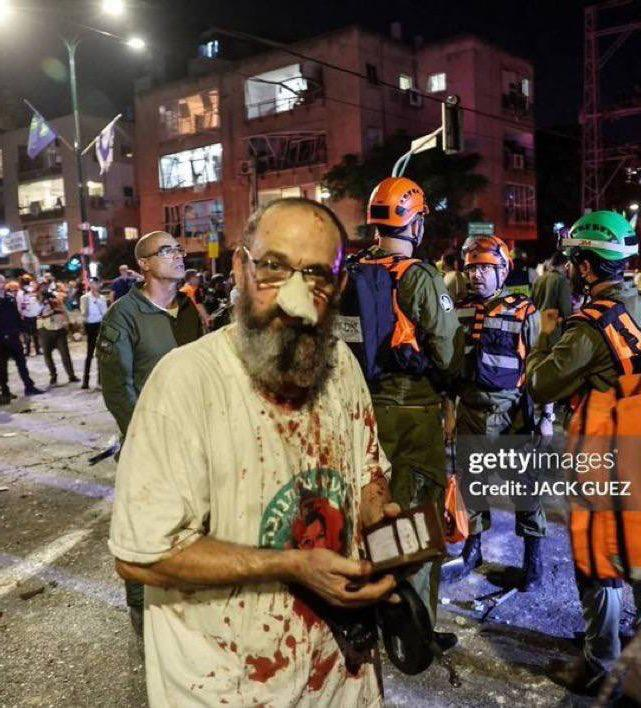 tevhidgundemi's tweet photo. 🔴 Tel Aviv’den yürek ısıtan (!) görüntüler gelmeye devam ediyor. https://t.co/geQZAR1ZQP