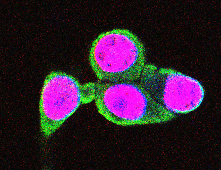 Science Magazine (@sciencemagazine) on Twitter photo The approved drug methotrexate can potentiate antitumor immune activity and shows signs of boosting the efficacy of checkpoint blockade immunotherapy in patients with solid tumors, according to a preliminary clinical trial.
Learn more in <a href="/ScienceTM/">Science Translational Medicine</a>: scim.ag/4kYO8ez The approved drug methotrexate can potentiate antitumor immune activity and shows signs of boosting the efficacy of checkpoint blockade immunotherapy in patients with solid tumors, according to a preliminary clinical trial.
Learn more in <a href="/ScienceTM/">Science Translational Medicine</a>: scim.ag/4kYO8ez