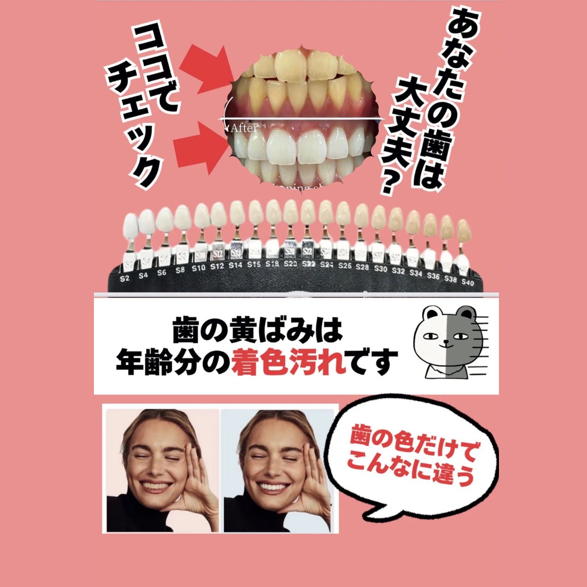 今日何する？☺️
ホワイトニング体験しませんか？🦷🫧

当日予約⭕️！！
２名様同時ご案内できます❤︎

食事制限なし！喫煙制限なし！
手ぶらでOK🙆‍♀️

#ホワイトニング
#美活
#聖蹟桜ヶ丘
#多摩市
#美肌