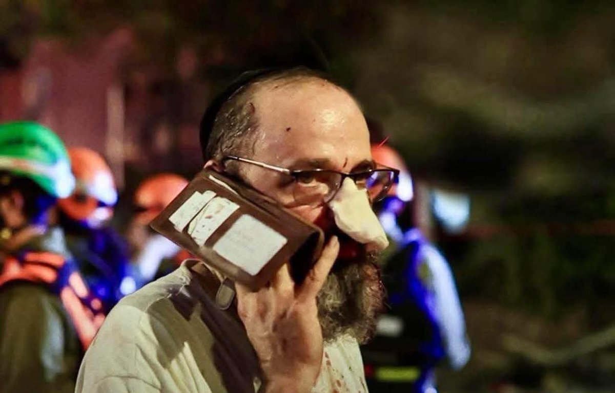 warfareanalysis's tweet image. An Israeli was injured in the nose during the Iranian attack, either by missile shrapnel or shrapnel from an interceptor.