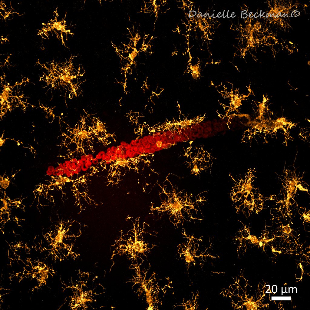 Can't miss #FluorescenceFriday!
How do the two most abundant glial cell types in the brain "welcome" red blood cells and other things coming through the blood vessels? Check the images below!  
🔬 🧠 

Astrocytes 🔵
Microglia 🟡  
Red blood cells 🔴