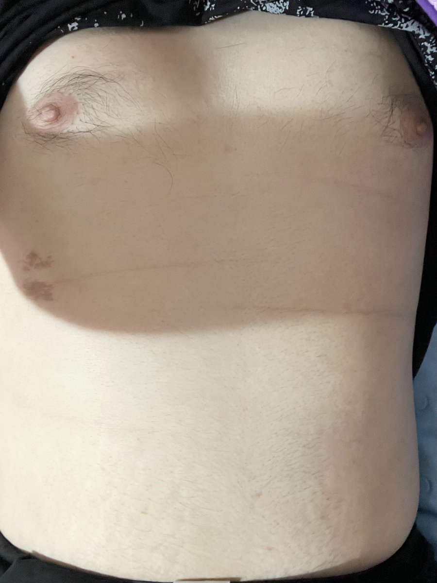 肉熊熊 哈利 (@gary106989) on Twitter photo 