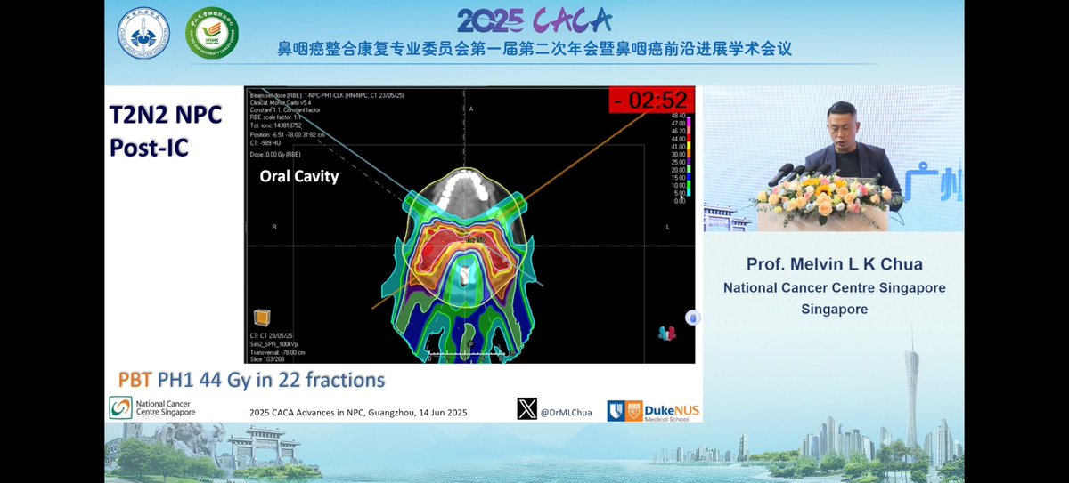 DrMLChua's tweet image. Always nice to visit Guangzhou for another #NasopharyngealCarcinoma
#ProtonTherapy meeting to discuss practice in the real world.
OS rates may be improving >70%, BUT still lots of patients with bad disease and early relapse so lots more to do!
Thanks to Prof Mai for the…
